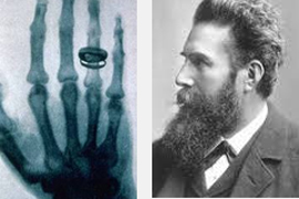 1895-ի նոյեմբերի 8-ին ֆիզիկոս Վիլհելմ Ռենտգենը բացահայտել է «ռենտգենյան ճառագայթները»