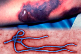 ՀՀ ԱՆ. Էբոլայի վիրուսի վարակի աղբյուրը, փոխանցումը, կլինիկան, կանխարգելումը