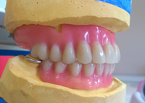 Молодые ученые из СПбГУ предложили печатать дешевые зубные протезы на 3D-принтере
