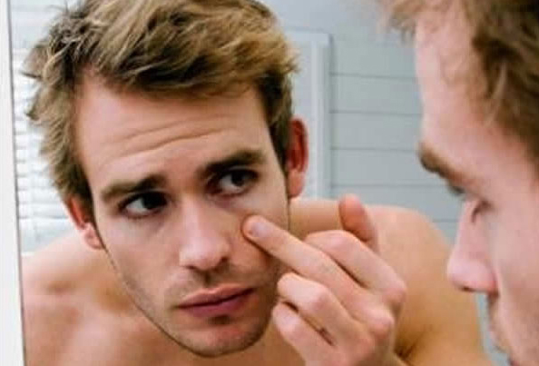 Мешки под глазами у мужчин: 7 причин, а также способы устранения