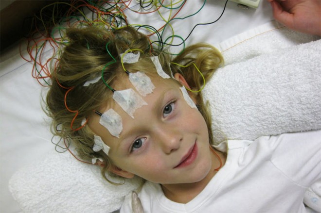 Приступы эпилепсии у детей младше 5 лет не всегда распознаются