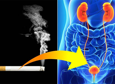 ԴՆԹ-ի ի՞նչ վնասումներ է առաջացնում ծխախոտի ծուխը և ինչպե՞ս է դա կապված միզապարկի քաղցկեղի հետ. oncology.am
