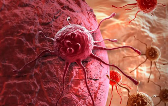 Ученые нашли способ помочь иммунитету бороться с раком