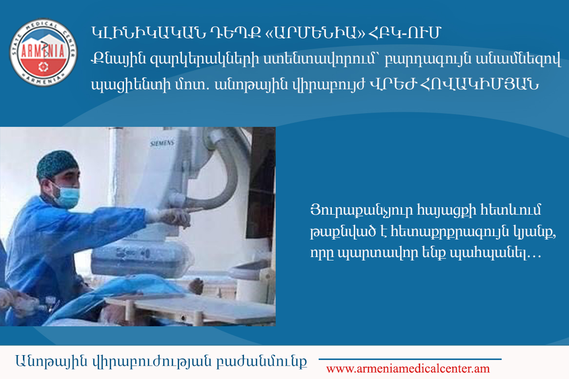 Կլինիկական դեպք՝ «Արմենիա» ՀԲԿ-ում. քնային զարկերակների ստենտավորում` բարդագույն անամնեզով պացիենտի մոտ.անոթային վիրաբույժ՝ Վրեժ Հովակիմյան