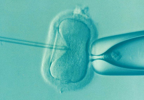 Искусственный интеллект выберет лучшие эмбрионы для ЭКО