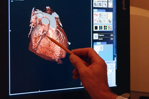 Ученые разработали устройство, диагностирующее сердечные приступы за считанные минуты