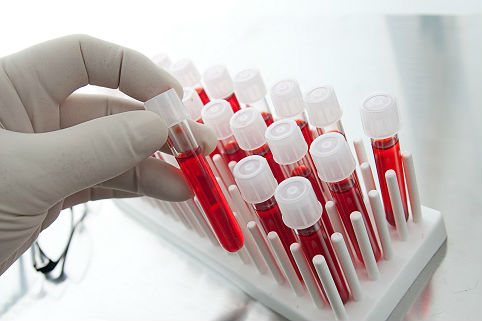 Регулярные анализы крови повысят выживаемость при раке простаты