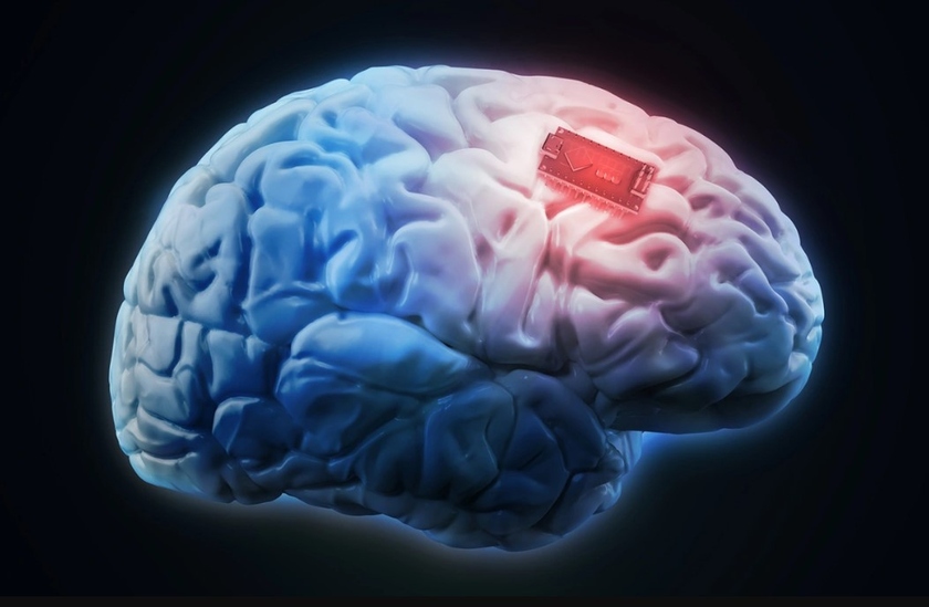 Имплантированные в мозг сенсоры подтвердили свою безопасность