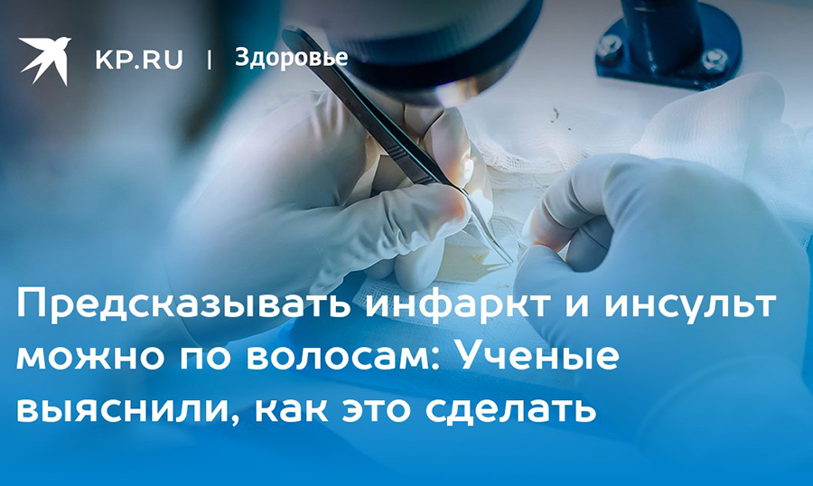 Предсказывать инфаркт и инсульт можно по волосам: Ученые выяснили, как это сделать