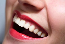 Տնային պայմաններում ատամների սպիտակեցում