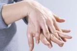 5 признаков возраста на коже рук