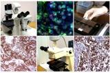 Определение молекулярно-биологических тканевых  маркеров иммуногистохимическим методом при онкологических заболеваниях