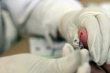 Նորվեգացի գիտնականները փոքրիկ սարք են ստեղծում արյան ակնթարթային հետազոտության համար. 1in.am