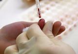 Почему анализ крови берут из безымянного пальца?