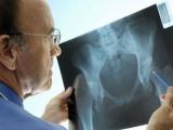 Остеопороз и остеоартроз — в чём разница?