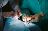 Почему пересадки органов от животных человеку заканчиваются провалом: объясняет главный трансплантолог России