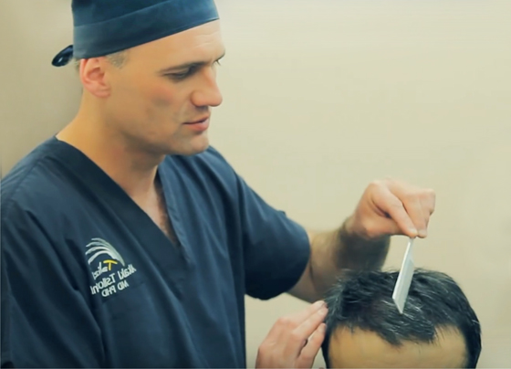 Երկար մազերի փոխպատվաստման բացառիկ վիրահատությունը կատարվեց նաև Հայաստանում