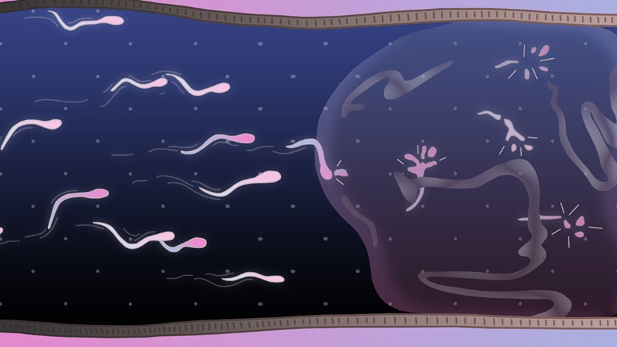 Контрацептивы для мужчин: гель как альтернатива вазэктомии